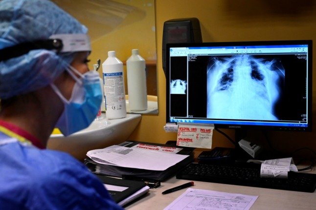 A nurse views an X-ray of the lungs of a Covid patient on October 13, 2021 at the Casalpalocco hospital, south of Rome. 